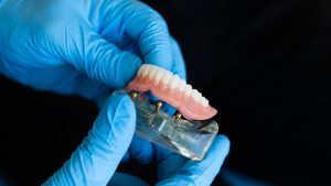 denture repairs