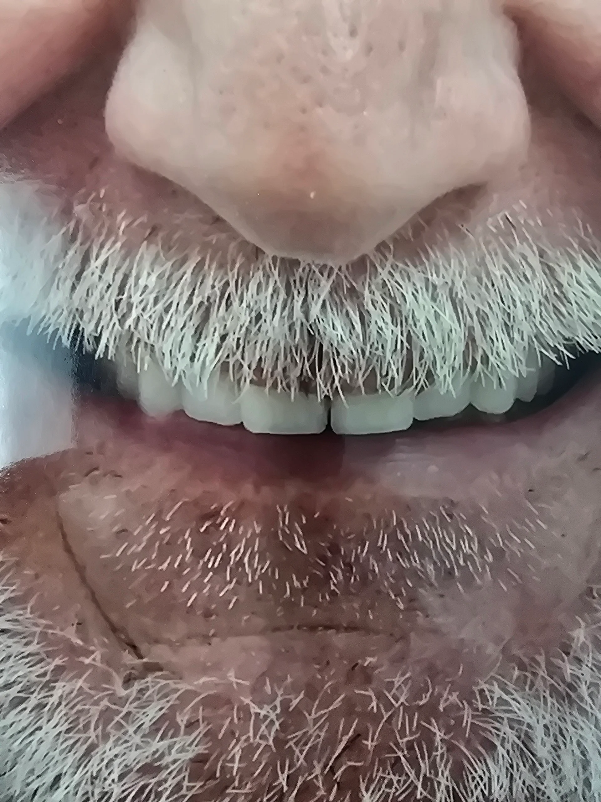 20250325_125100